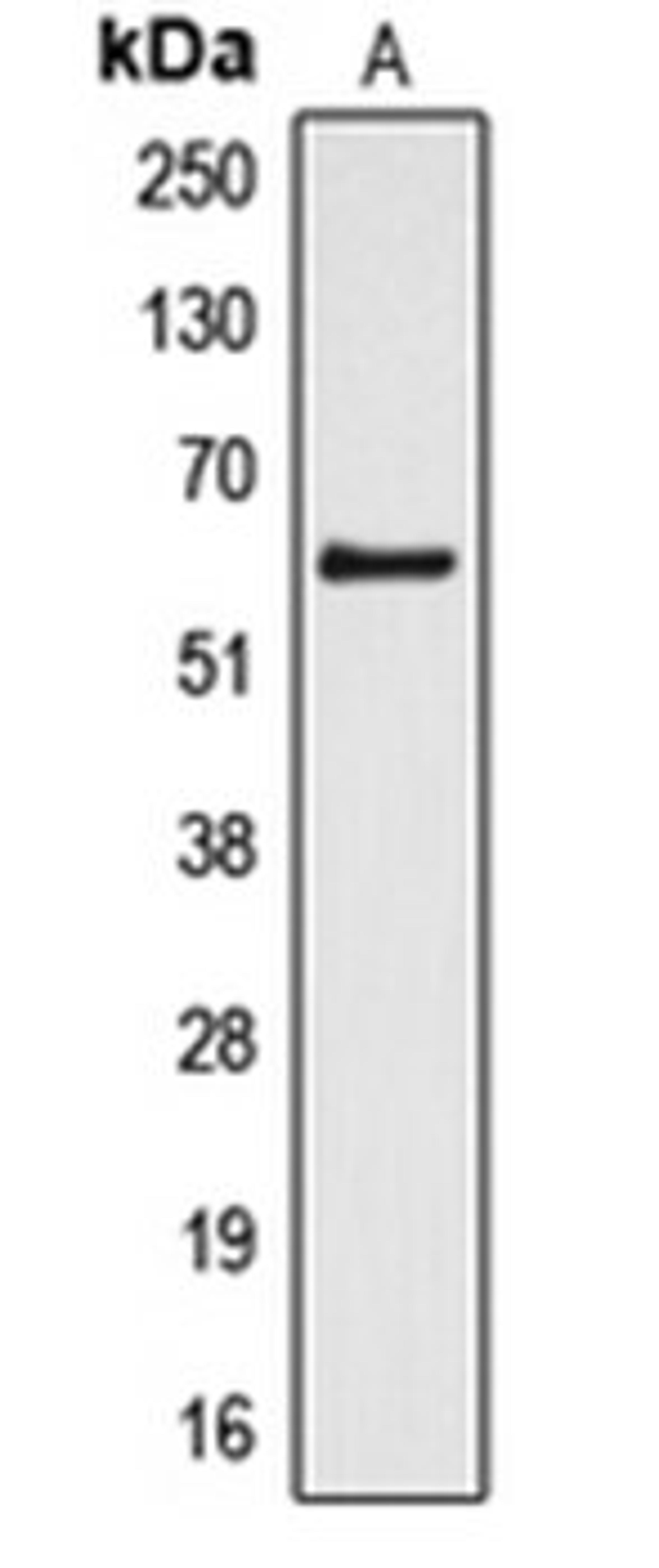 Western blot analysis of HL60 (Lane 1) whole cell lysates using CYP4Z1 antibody