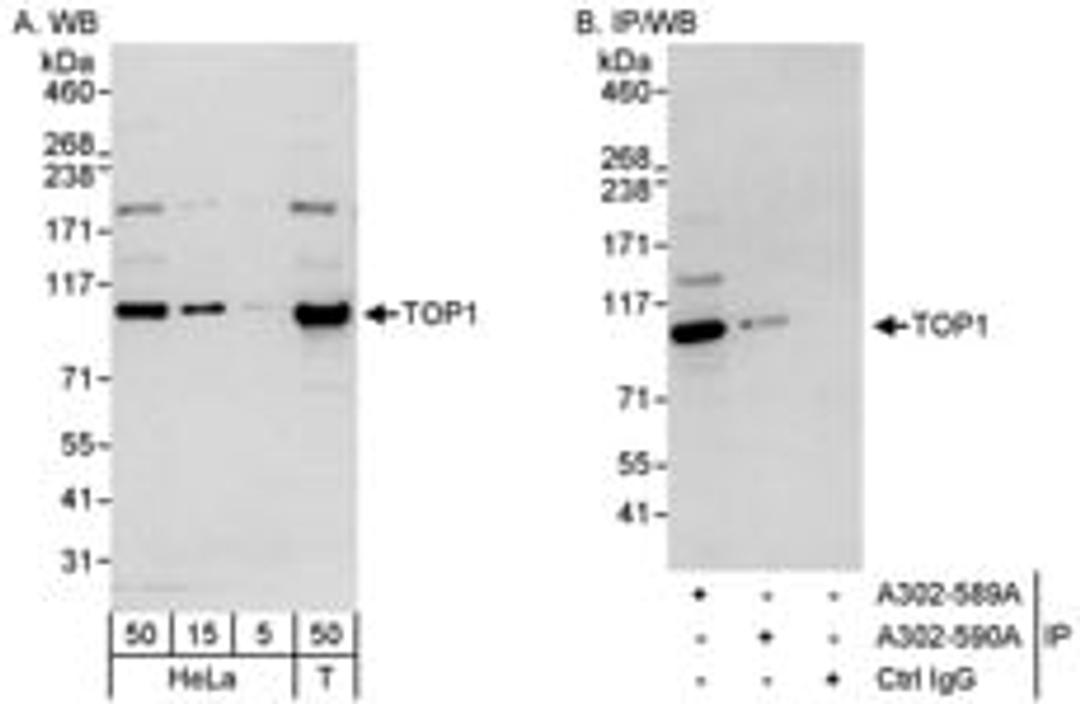 Detection of human TOP1 by western blot and immunoprecipitation.