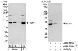 Detection of human TOP1 by western blot and immunoprecipitation.