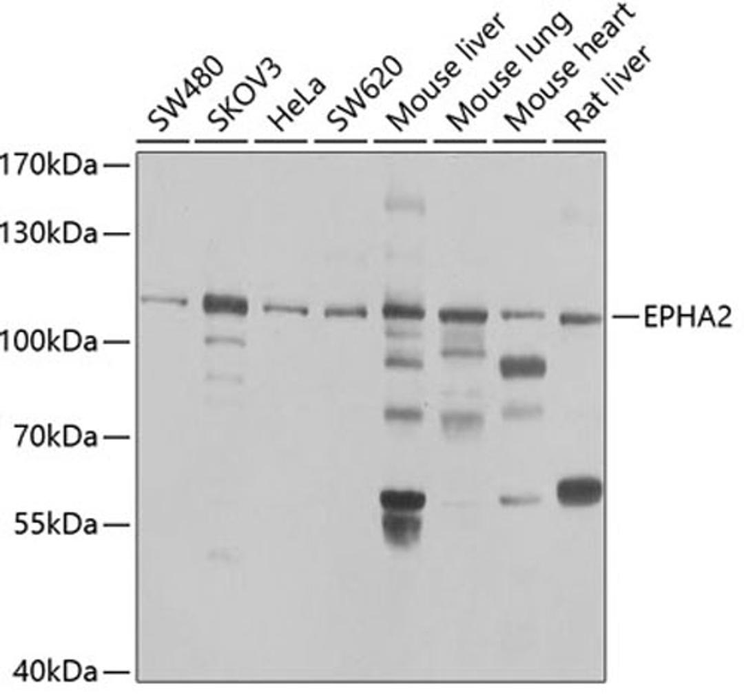 Western blot - EPHA2 antibody (A7183)