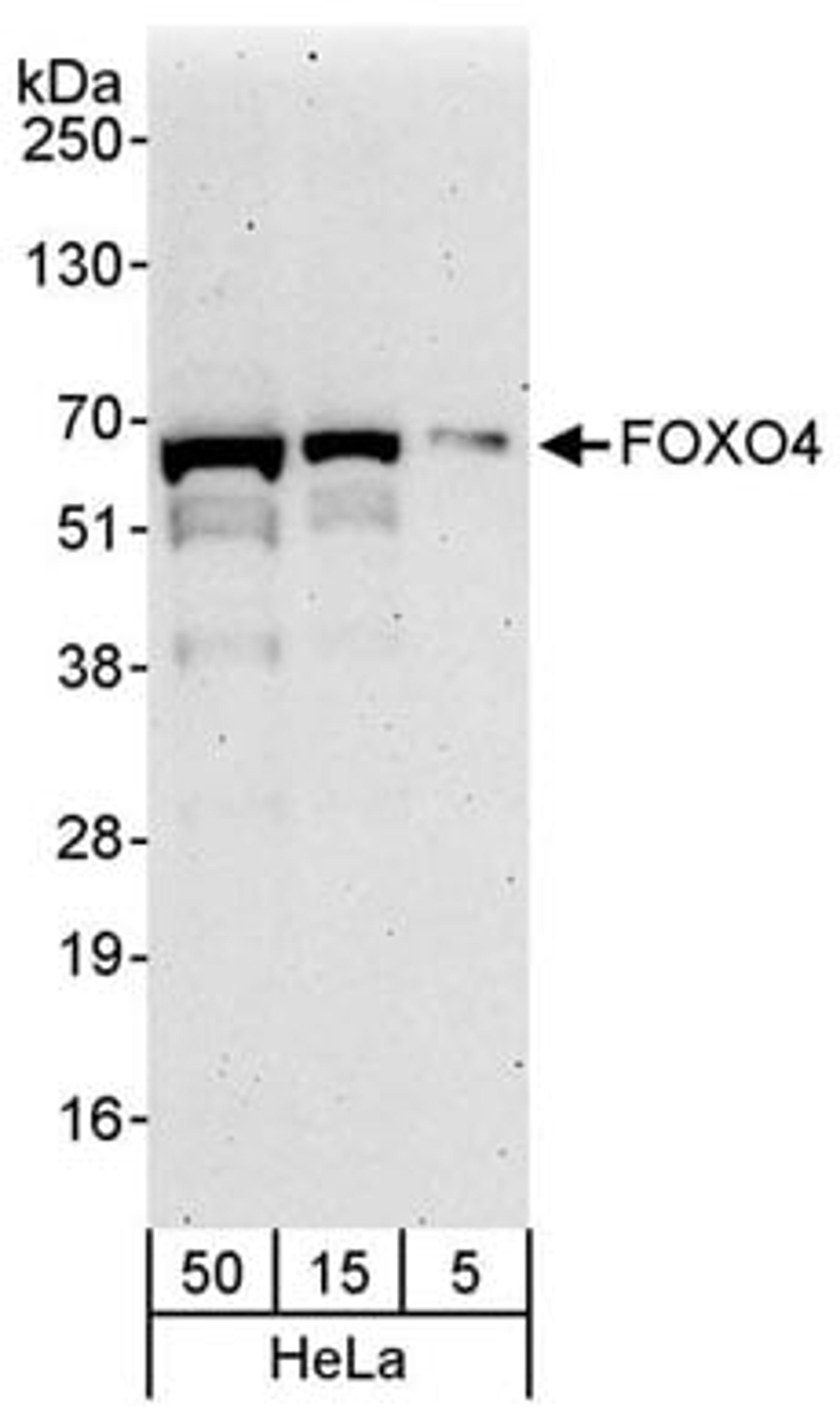 Detection of human FOXO4 by western blot.