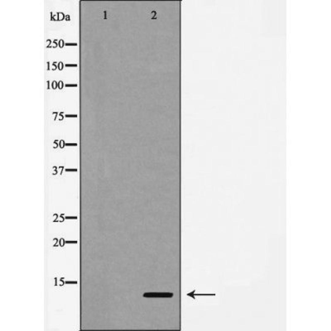 Western blot analysis of human lung carcinoma tissue using Caspase 9 (Cleaved-Asp330) antibody