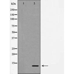 Western blot analysis of human lung carcinoma tissue using Caspase 9 (Cleaved-Asp330) antibody