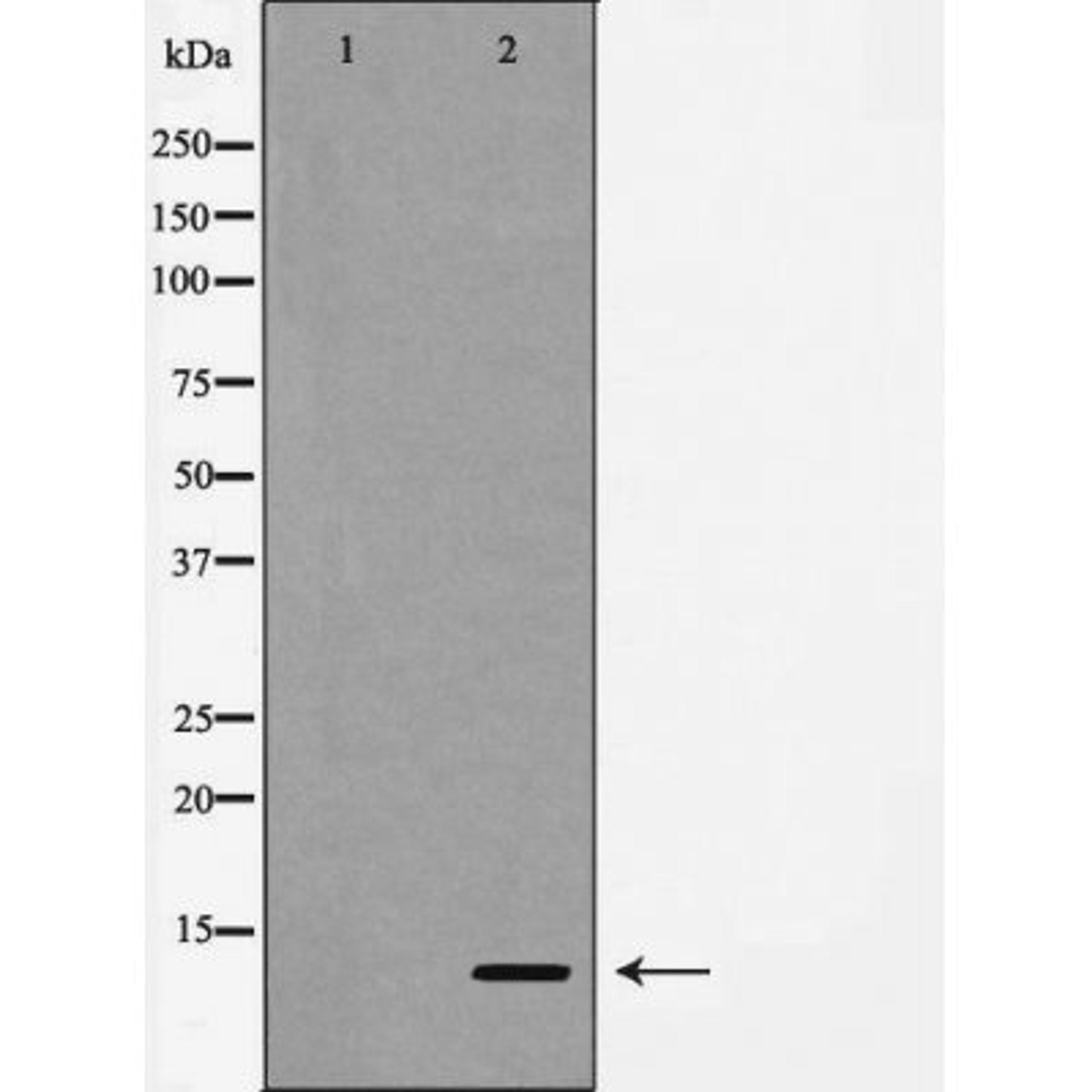 Western blot analysis of human lung carcinoma tissue using Caspase 9 (Cleaved-Asp330) antibody