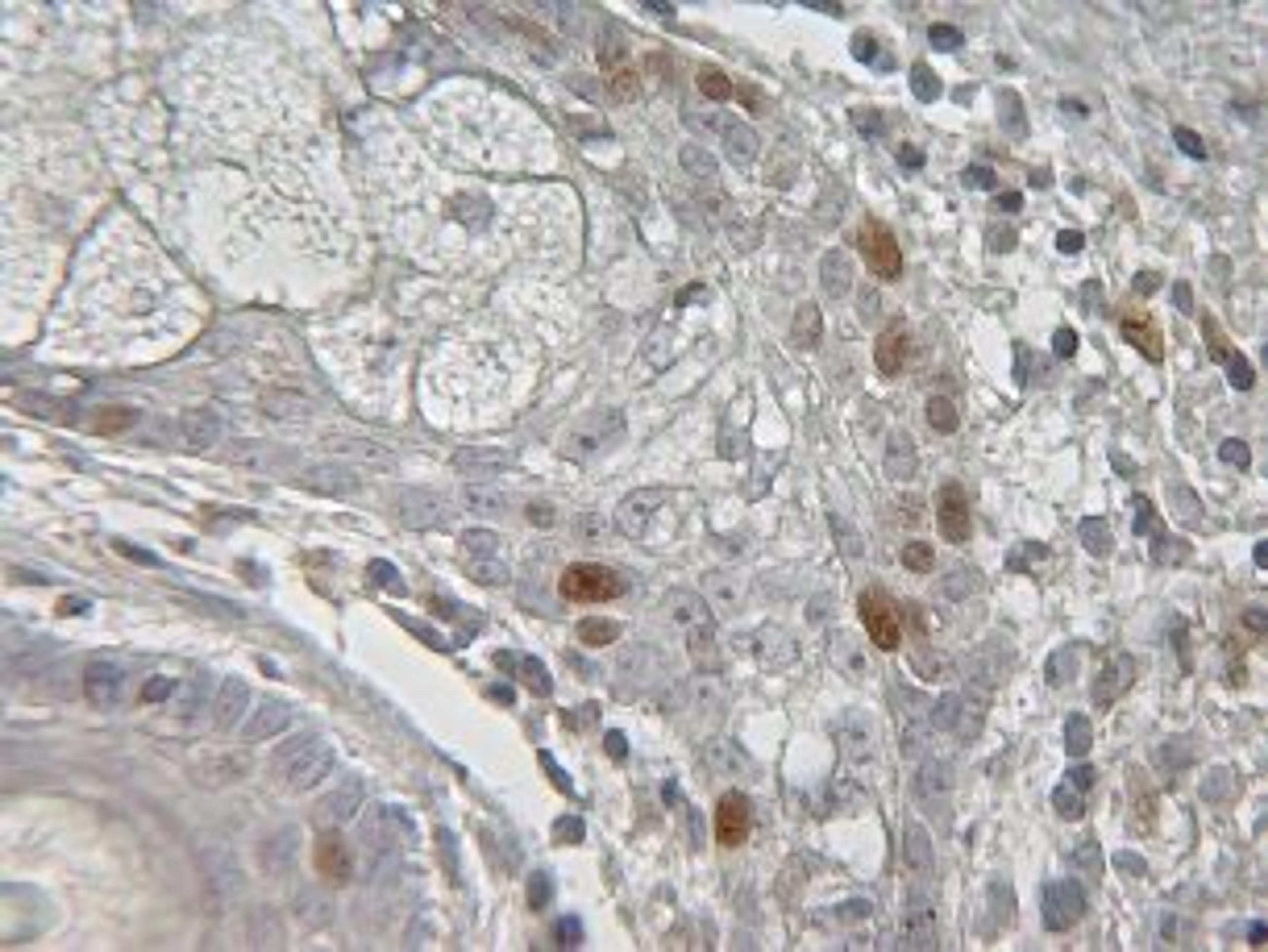 Immunohistochemical staining of using Ki67 antibody