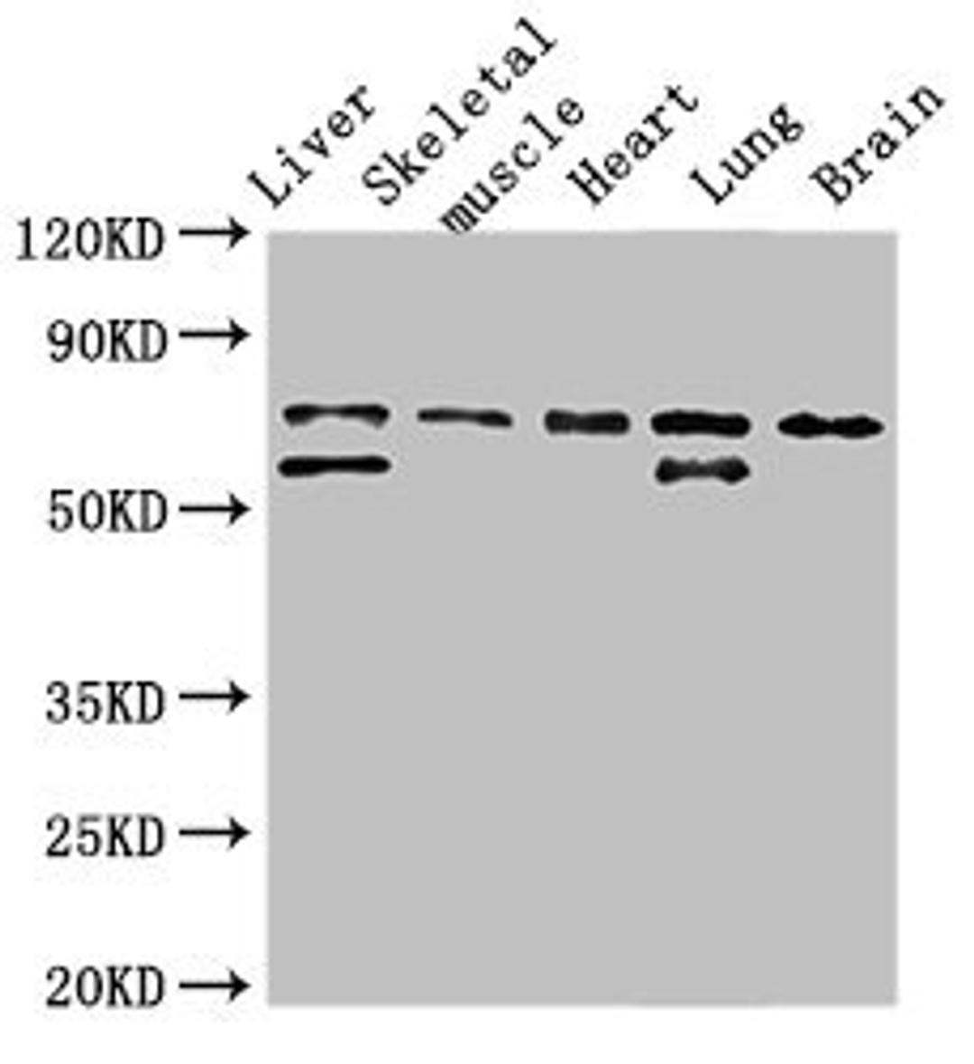 Western Blot. Positive WB detected in: Rat liver tissue, Rat skeletal muscle tissue, Mouse heart tissue, Mouse lung tissue, Mouse brain tissue. All lanes: BIRC2 antibody at 3.5ug/ml. Secondary. Goat polyclonal to rabbit IgG at 1/50000 dilution. Predicted band size: 70, 65 kDa. Observed band size: 70, 65 kDa. 