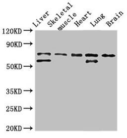 Western Blot. Positive WB detected in: Rat liver tissue, Rat skeletal muscle tissue, Mouse heart tissue, Mouse lung tissue, Mouse brain tissue. All lanes: BIRC2 antibody at 3.5ug/ml. Secondary. Goat polyclonal to rabbit IgG at 1/50000 dilution. Predicted band size: 70, 65 kDa. Observed band size: 70, 65 kDa. 