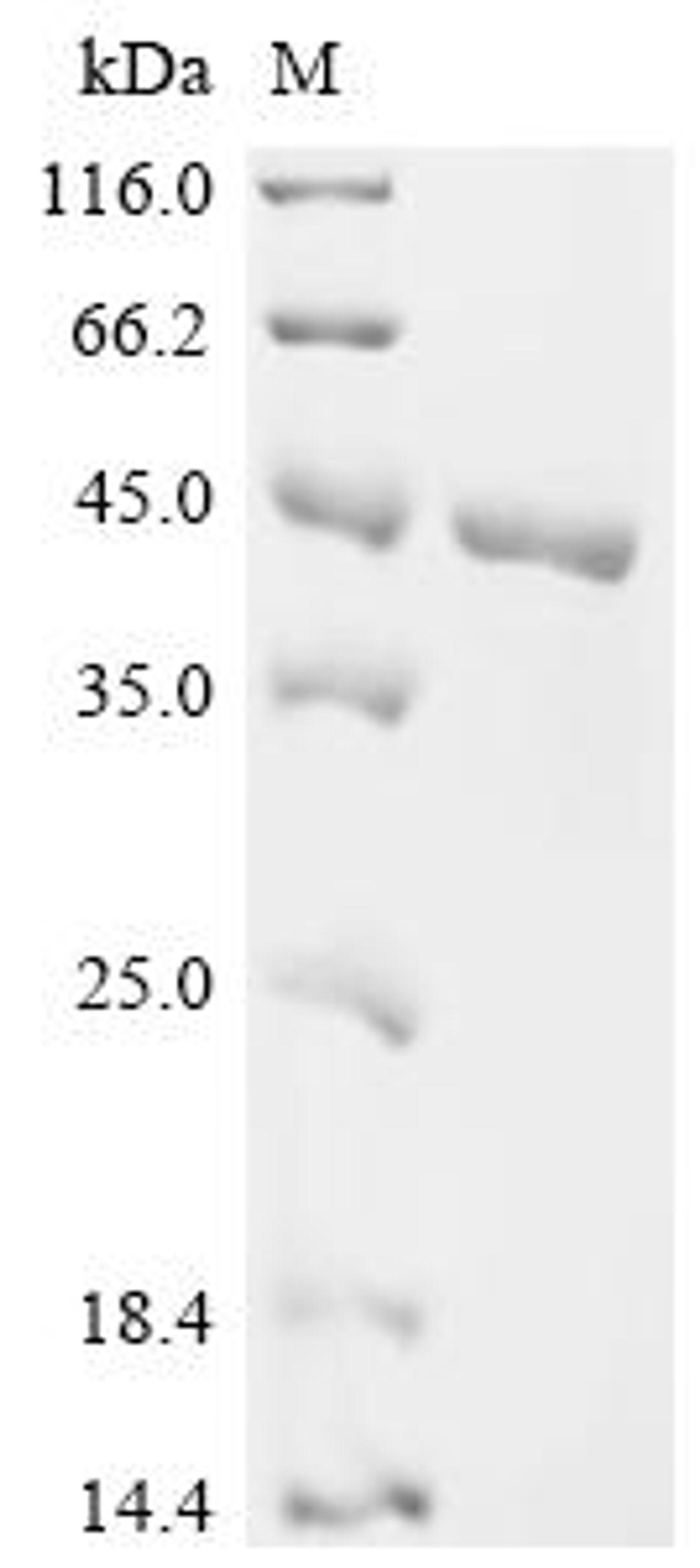 (Tris-Glycine gel) Discontinuous SDS-PAGE (reduced) with 5% enrichment gel and 15% separation gel.