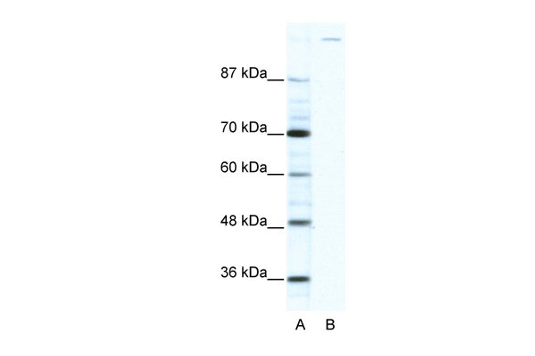 Antibody used in WB on Human HepG2 at 2.5 ug/ml.