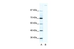 Antibody used in WB on Human HepG2 at 2.5 ug/ml.