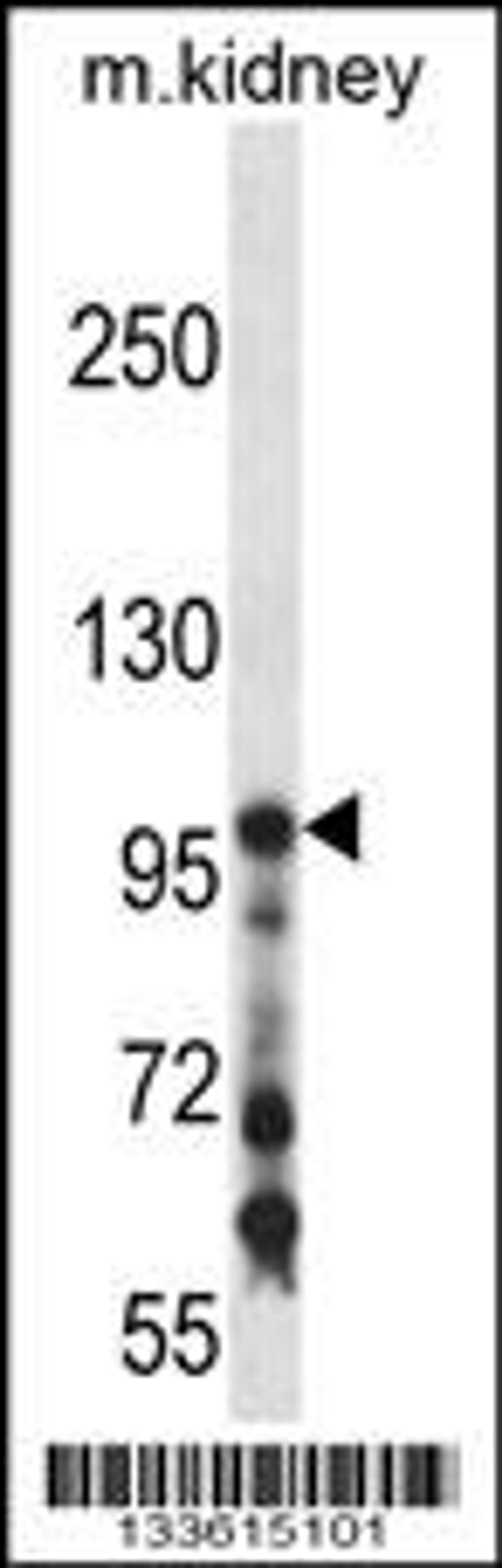 Western blot analysis in mouse kidney tissue lysates (35ug/lane).