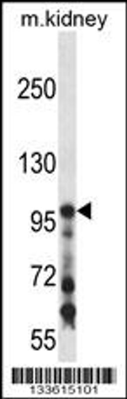 Western blot analysis in mouse kidney tissue lysates (35ug/lane).