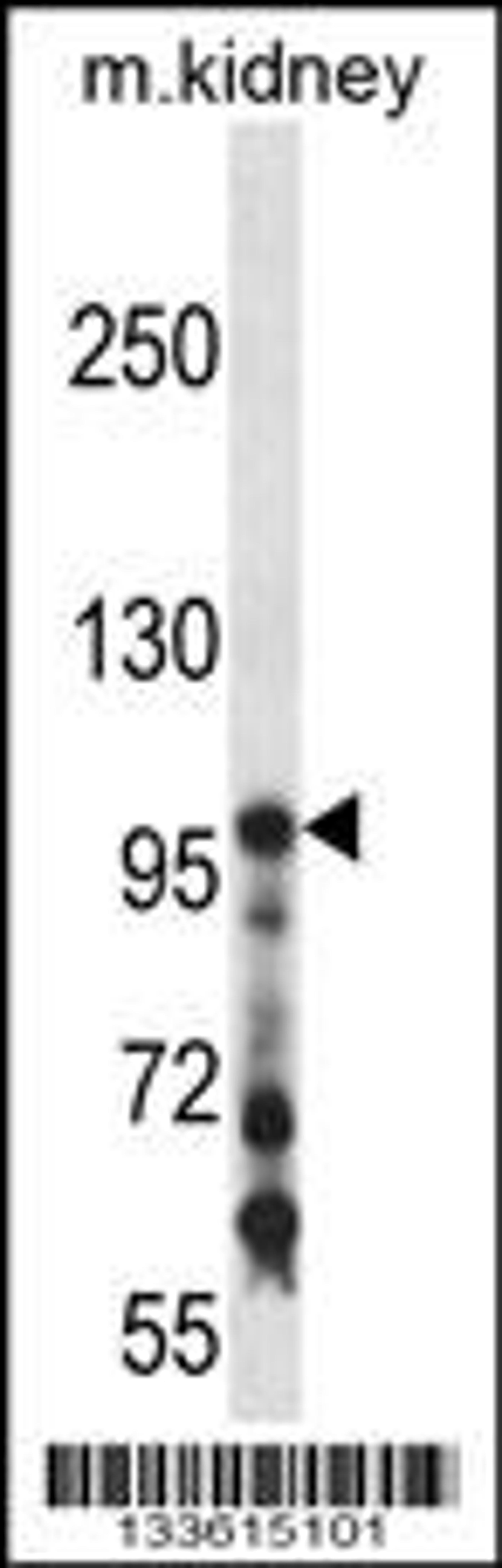 Western blot analysis in mouse kidney tissue lysates (35ug/lane).