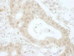 Detection of human Tip41 by immunohistochemistry.