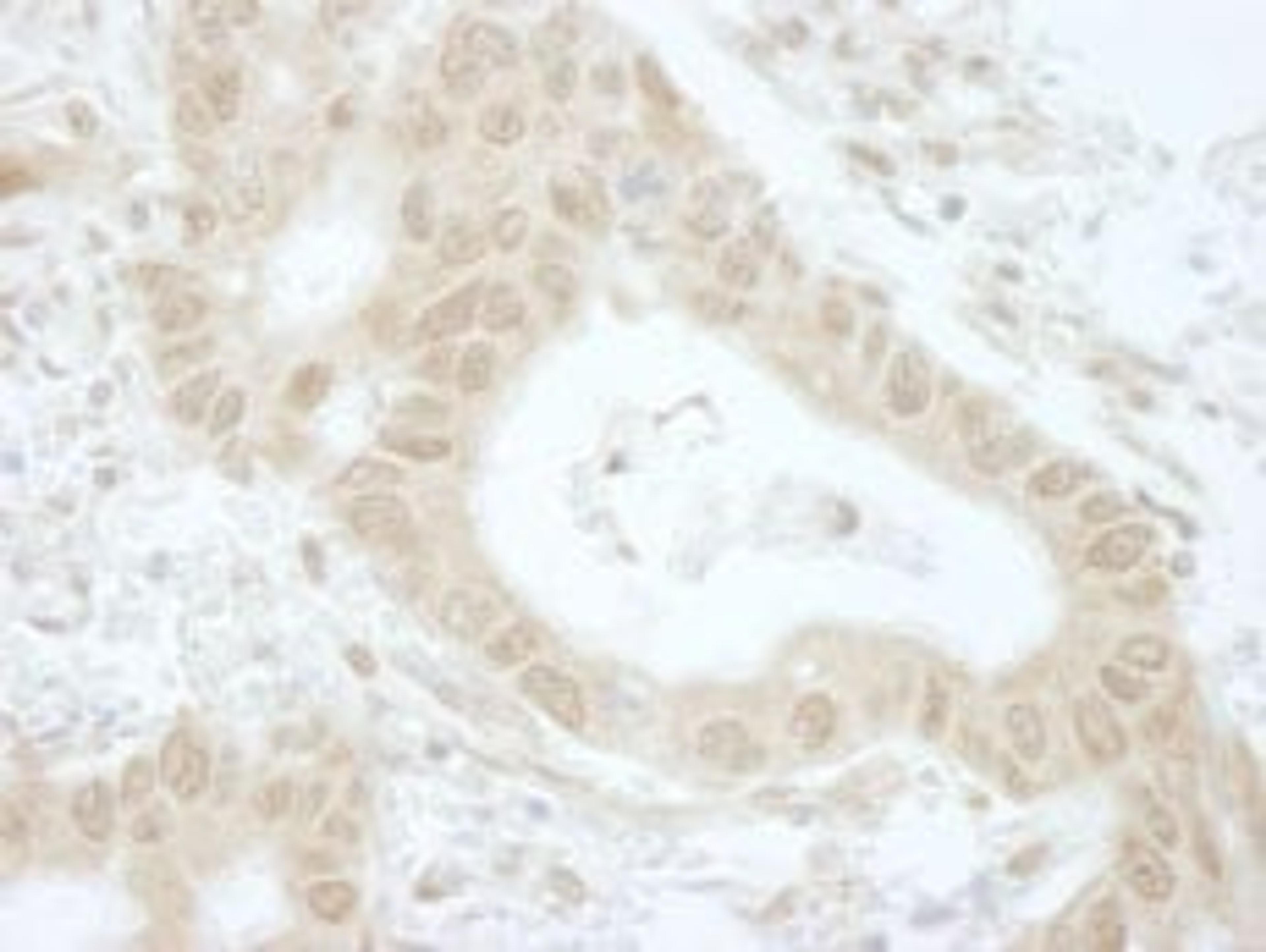 Detection of human Tip41 by immunohistochemistry.