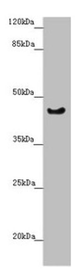 Western blot. All lanes: RBM17 antibody at 2.35µg/ml + U251 whole cell lysate. Secondary. Goat polyclonal to rabbit IgG at 1/10000 dilution. Predicted band size: 45 kDa. Observed band size: 45 kDa