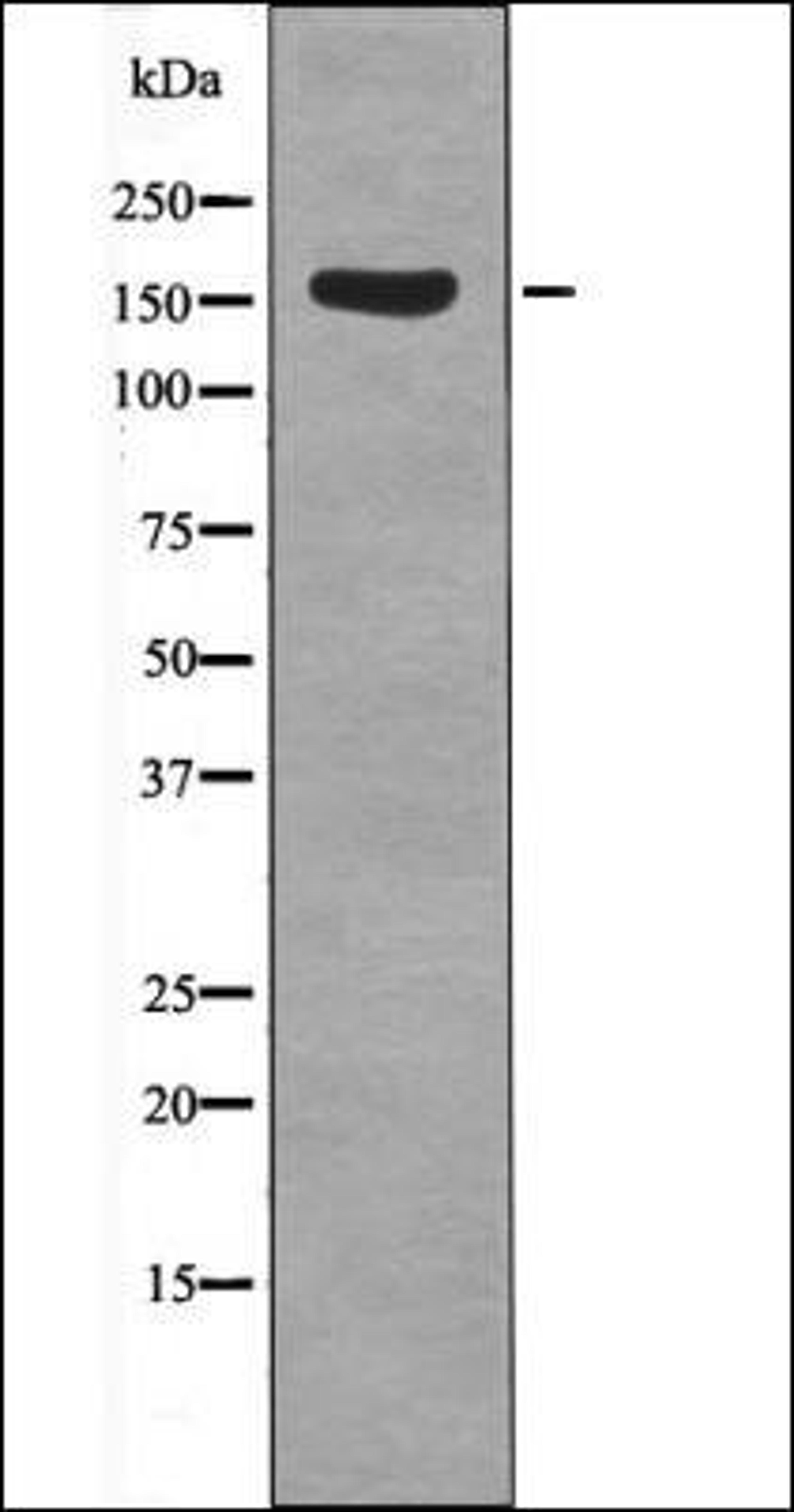 Western blot analysis of Insulin treated HeLa whole cell lysates using Met -Phospho-Tyr1235- antibody