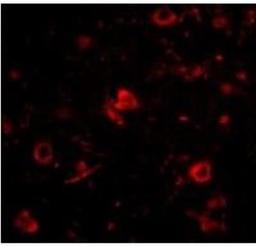 Immunocytochemistry/Immunofluorescence: Nanos3 Antibody [NBP1-76919] - in Human Brain cells.