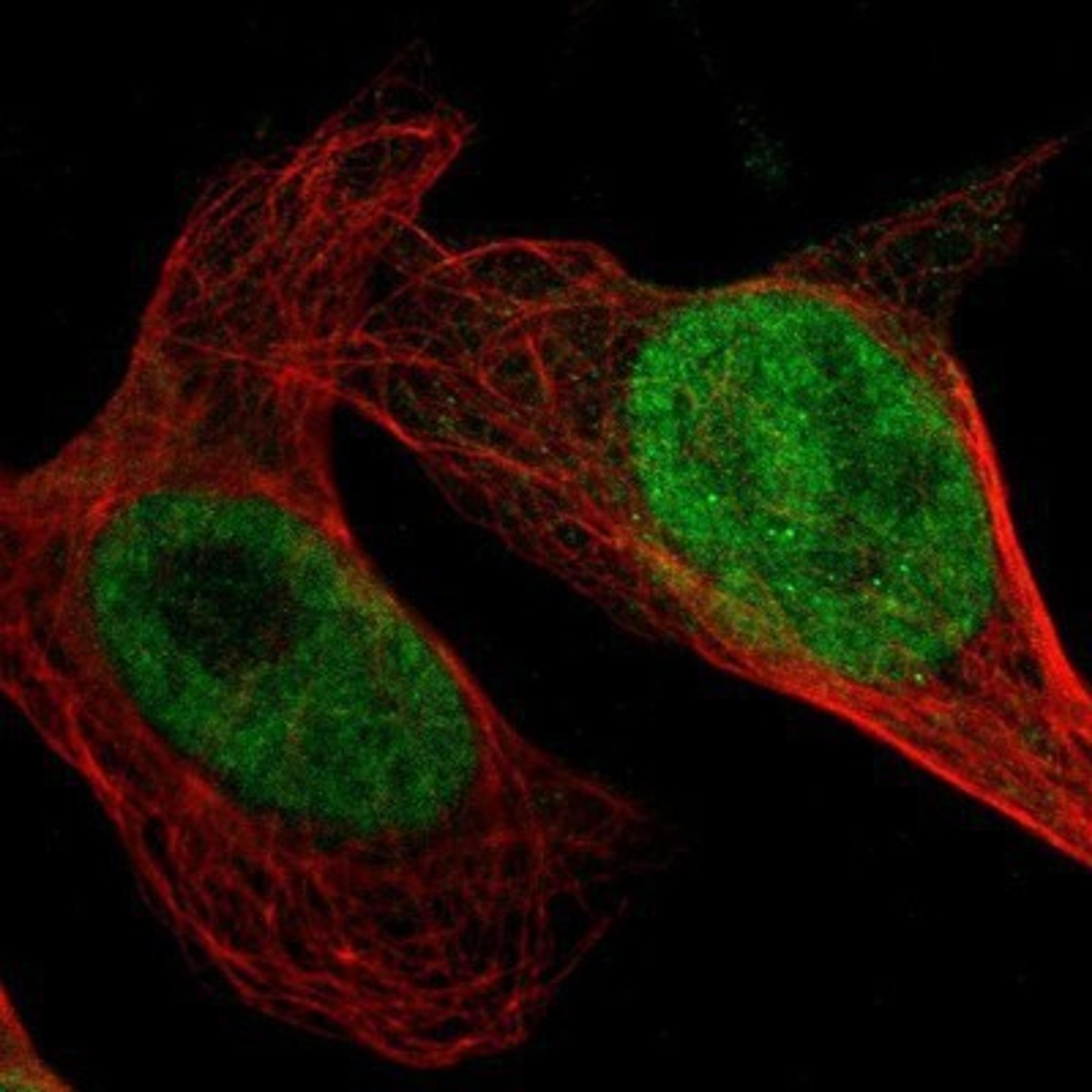 Immunocytochemistry/Immunofluorescence: GPKOW Antibody [NBP1-81801] - Staining of human cell line U-2 OS shows positivity in nucleus but not nucleoli.