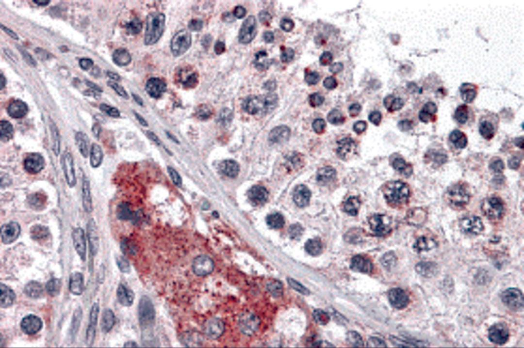 Immunohistochemistry of PTCHD2 in human testis tissue with PTCHD2 antibody at 5 &#956;g/mL.