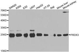 Western blot analysis of extracts of various cell lines using PRDX3 antibody