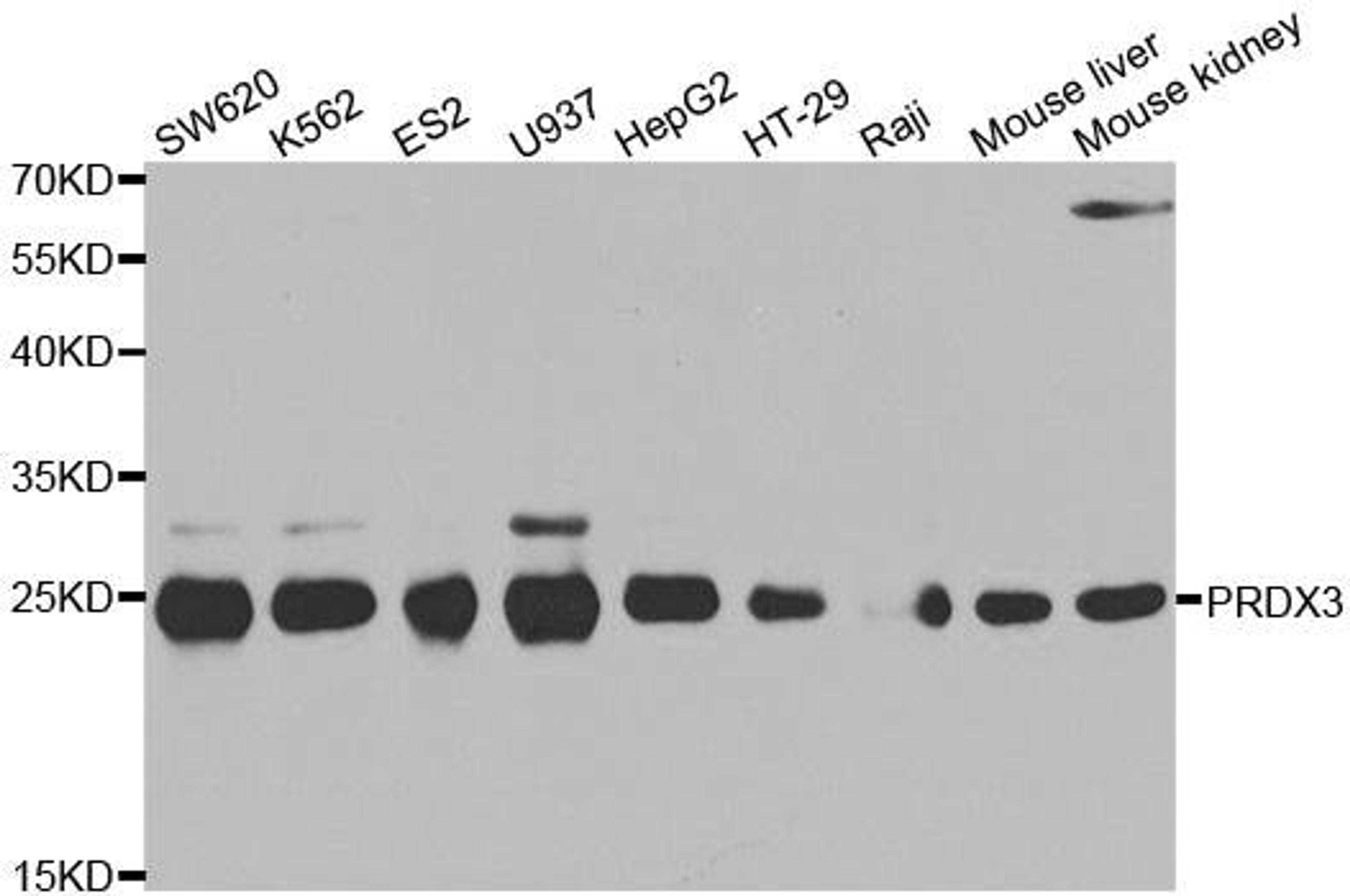 Western blot analysis of extracts of various cell lines using PRDX3 antibody