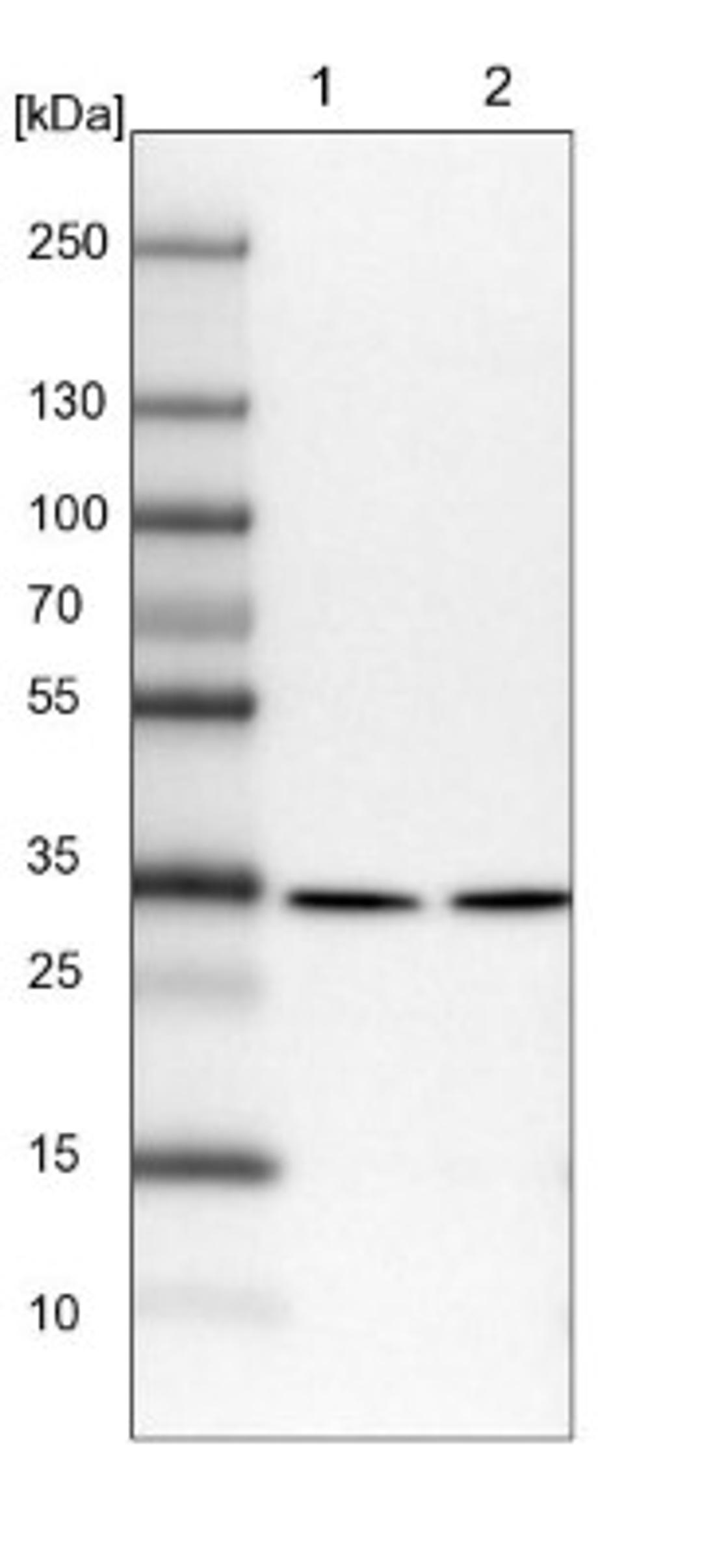 Western Blot: SFXN1 Antibody [NBP1-83708] - Lane 1: NIH-3T3 cell lysate (Mouse embryonic fibroblast cells)<br/>Lane 2: NBT-II cell lysate (Rat Wistar bladder tumour cells)