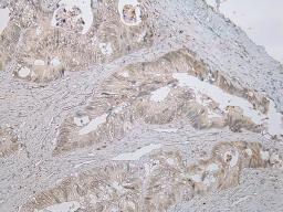 Immunohistochemical staining of Human Colorectal tissue using STAB1 antibody