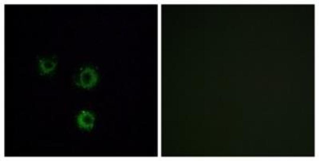 Immunocytochemistry/Immunofluorescence: TAS2R14 Antibody [NBP1-71304] - Analysis of MCF7 cells, using . The picture on the right is treated with the synthesized peptide.