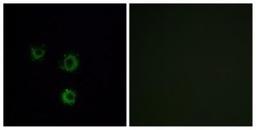 Immunocytochemistry/Immunofluorescence: TAS2R14 Antibody [NBP1-71304] - Analysis of MCF7 cells, using . The picture on the right is treated with the synthesized peptide.