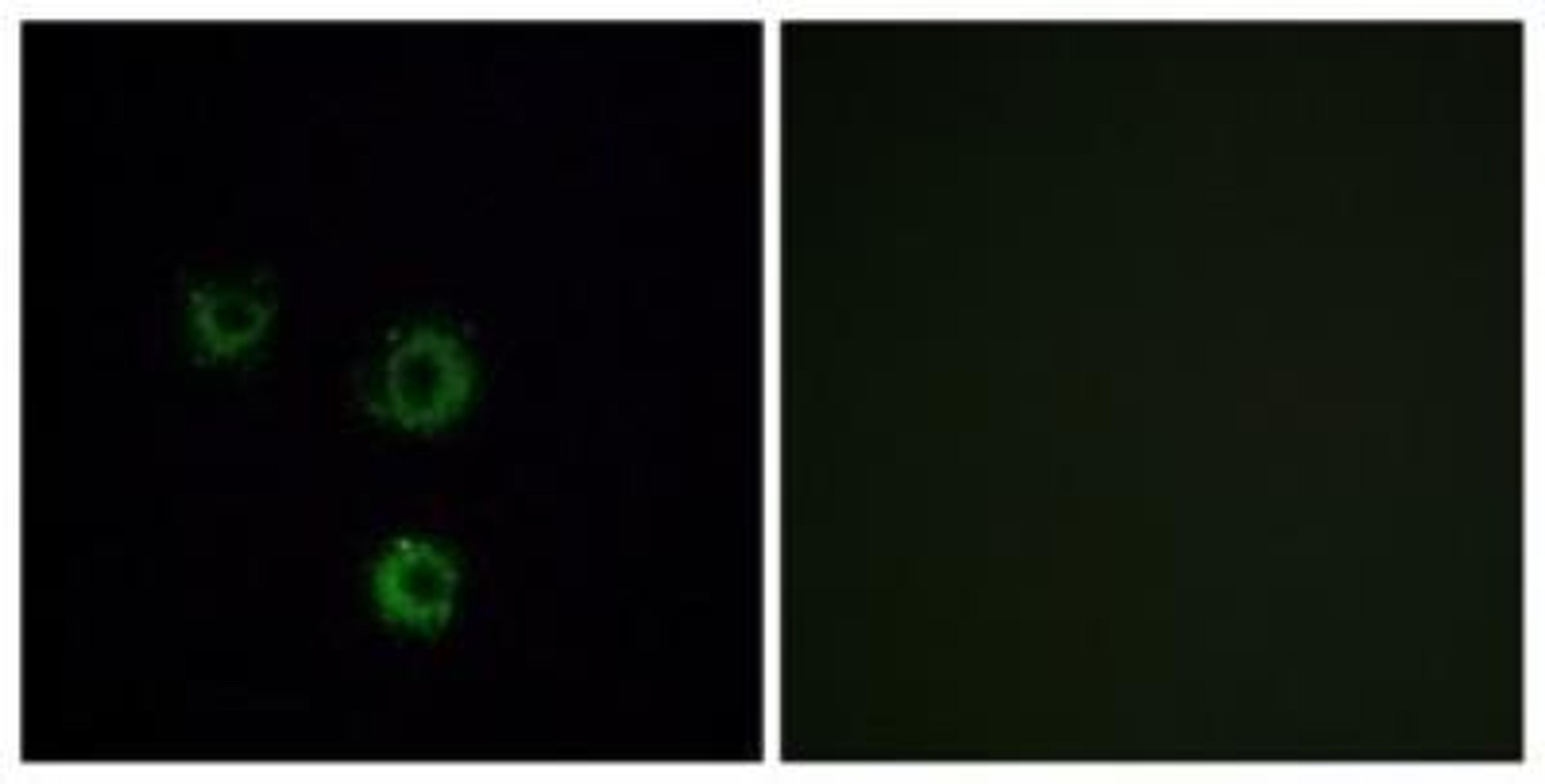 Immunocytochemistry/Immunofluorescence: TAS2R14 Antibody [NBP1-71304] - Analysis of MCF7 cells, using . The picture on the right is treated with the synthesized peptide.