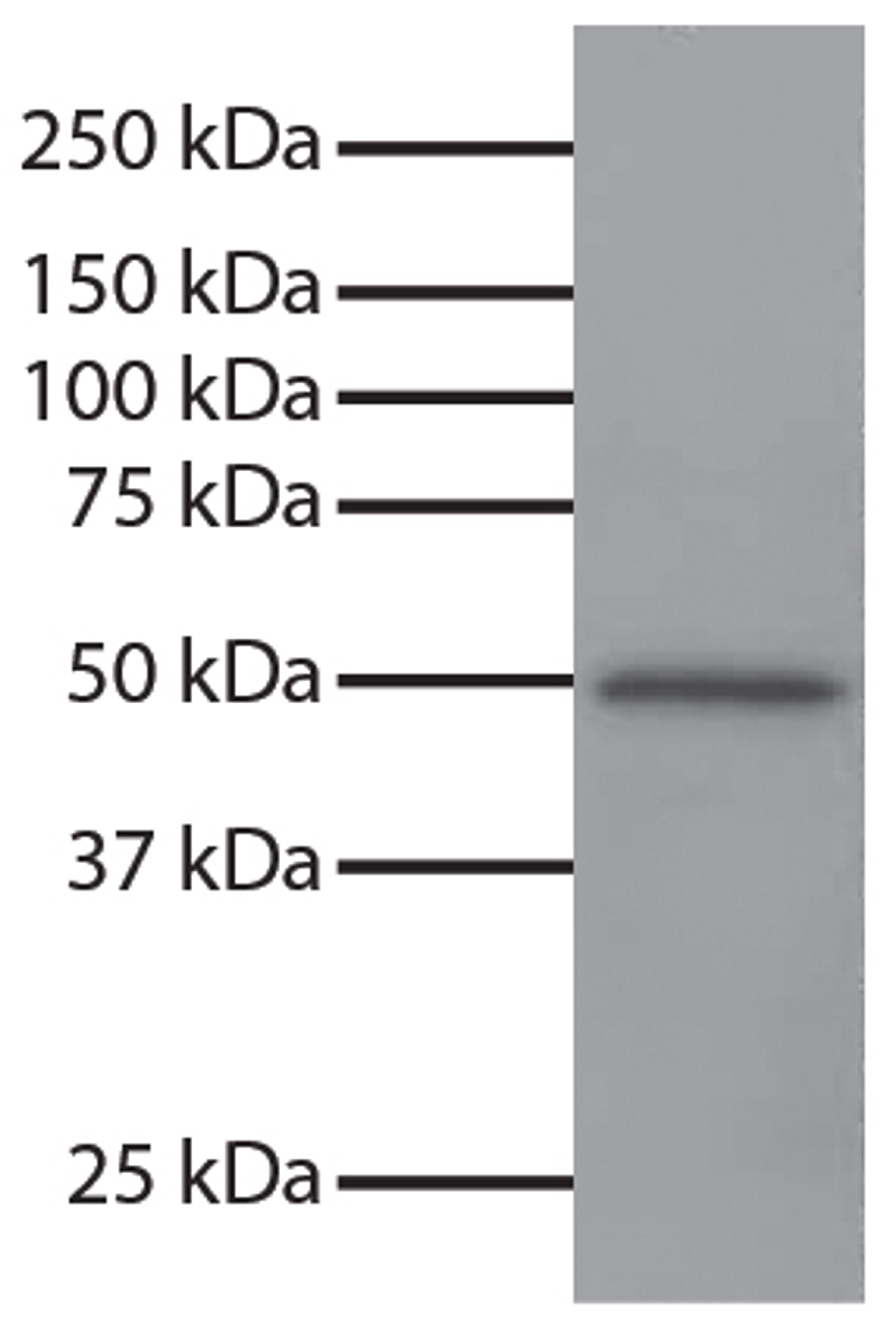 Total cell lysates from Jurkat cells were resolved by electrophoresis, transferred to PVDF membrane, and probed with Mouse Anti-GSK-3?-UNLB (Cat. No. 99-740). Proteins were visualized using Goat Anti-Mouse IgG, Human ads-HRP secondary antibody and chemilu