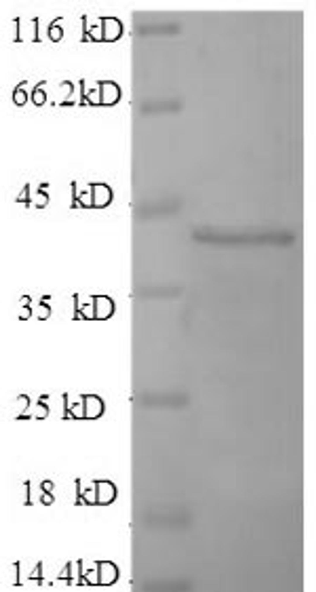 (Tris-Glycine gel) Discontinuous SDS-PAGE (reduced) with 5% enrichment gel and 15% separation gel.