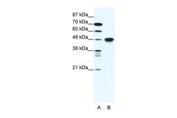 Antibody used in WB on Human Jurkat cells at 1.25 ug/ml.