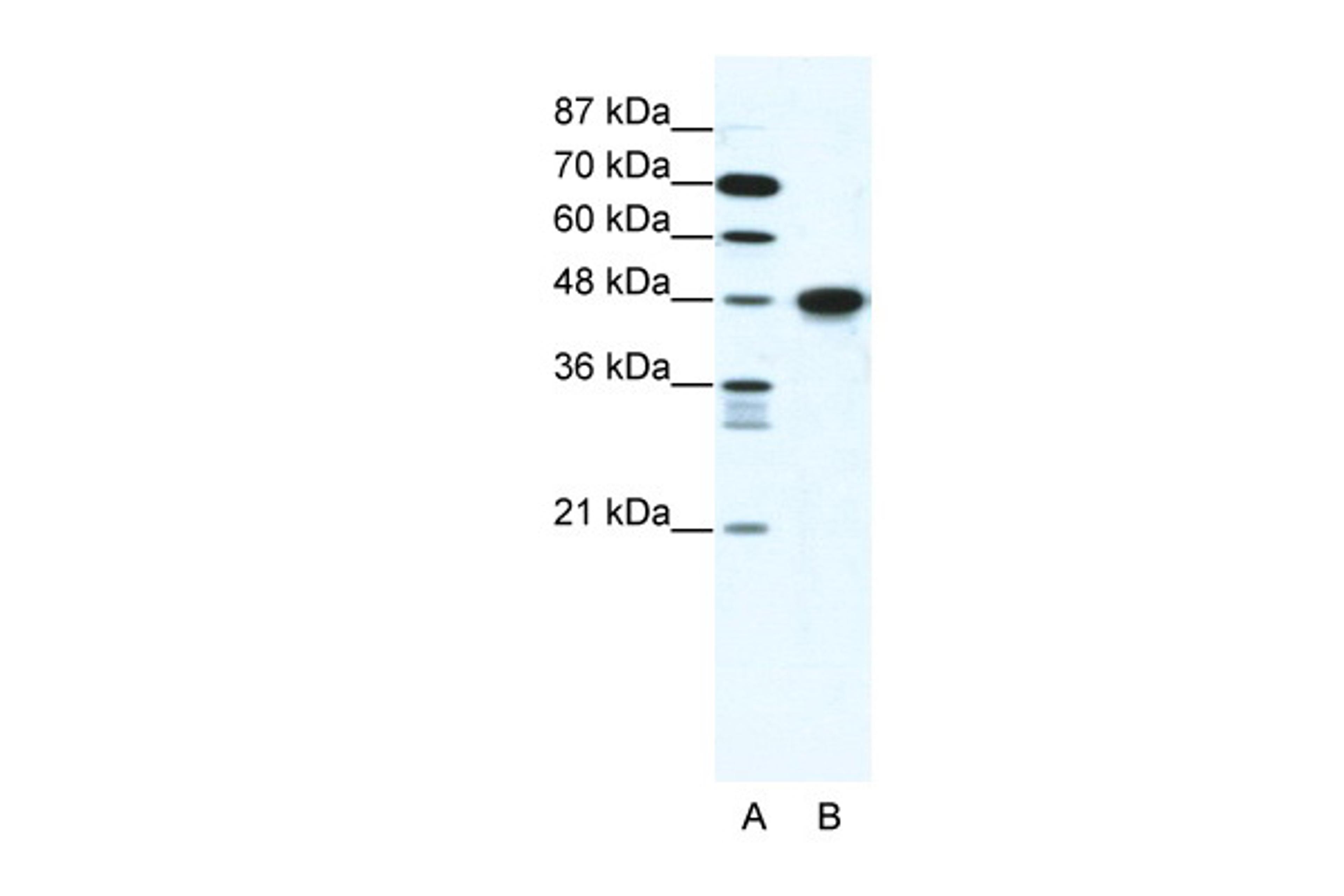 Antibody used in WB on Human Jurkat cells at 1.25 ug/ml.