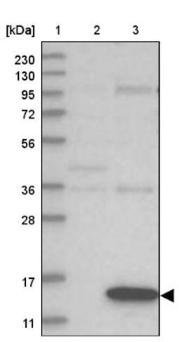 Western Blot: GABARAPL2 Antibody [NBP1-88883] - Lane 1: Marker [kDa] 230, 130, 95, 72, 56, 36, 28, 17, 11<br/>Lane 2: Human cell line RT-4<br/>Lane 3: Human cell line U-251MG sp