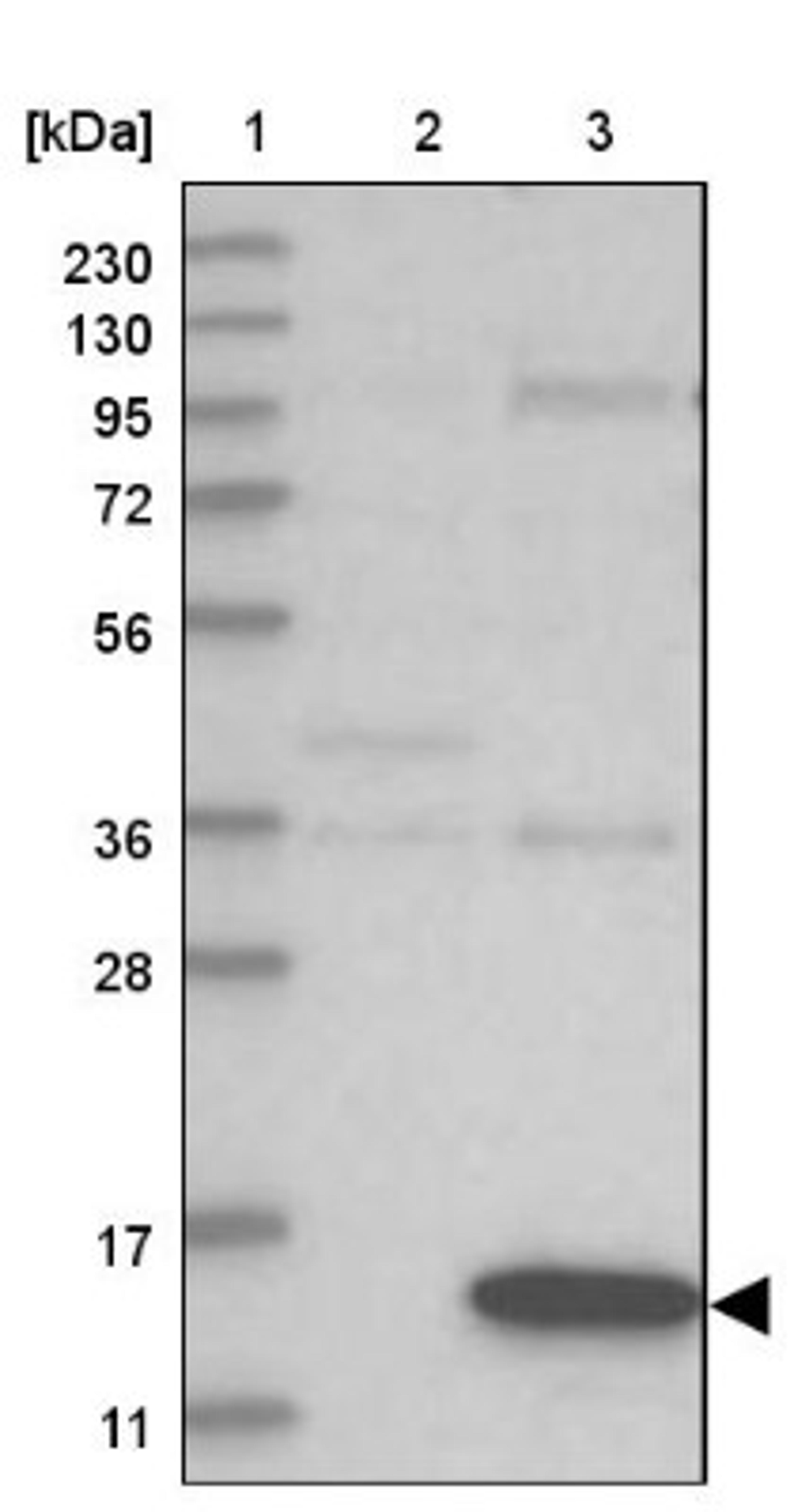 Western Blot: GABARAPL2 Antibody [NBP1-88883] - Lane 1: Marker [kDa] 230, 130, 95, 72, 56, 36, 28, 17, 11<br/>Lane 2: Human cell line RT-4<br/>Lane 3: Human cell line U-251MG sp