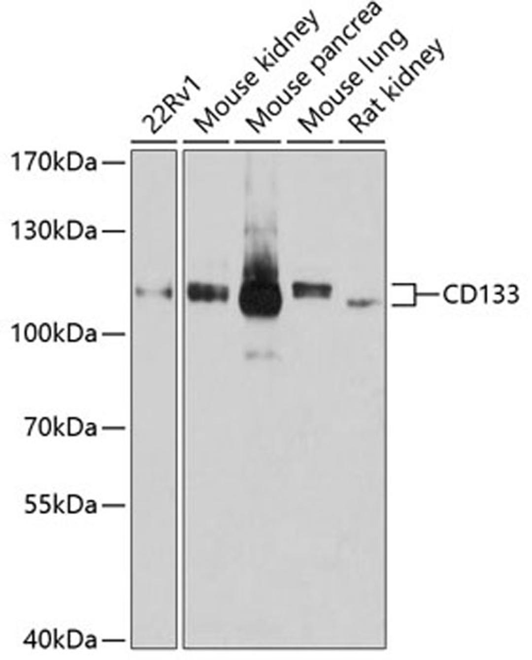 Western blot - CD133 antibody (A12711)