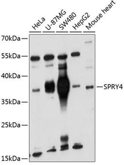 Western blot - SPRY4 antibody (A6263)