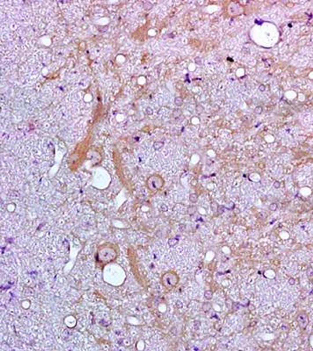 Immunohistochemical analysis of formalin fixed and paraffin embedded rat brain tissue using IL18 antibody