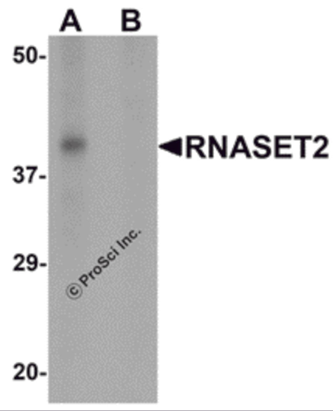 Western blot analysis of RNASET2 in SW480 cell lysate with RNASET2 antibody at 1 &#956;g/mL in (A) the absence and (B) the presence of blocking peptide.