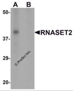 Western blot analysis of RNASET2 in SW480 cell lysate with RNASET2 antibody at 1 &#956;g/mL in (A) the absence and (B) the presence of blocking peptide.