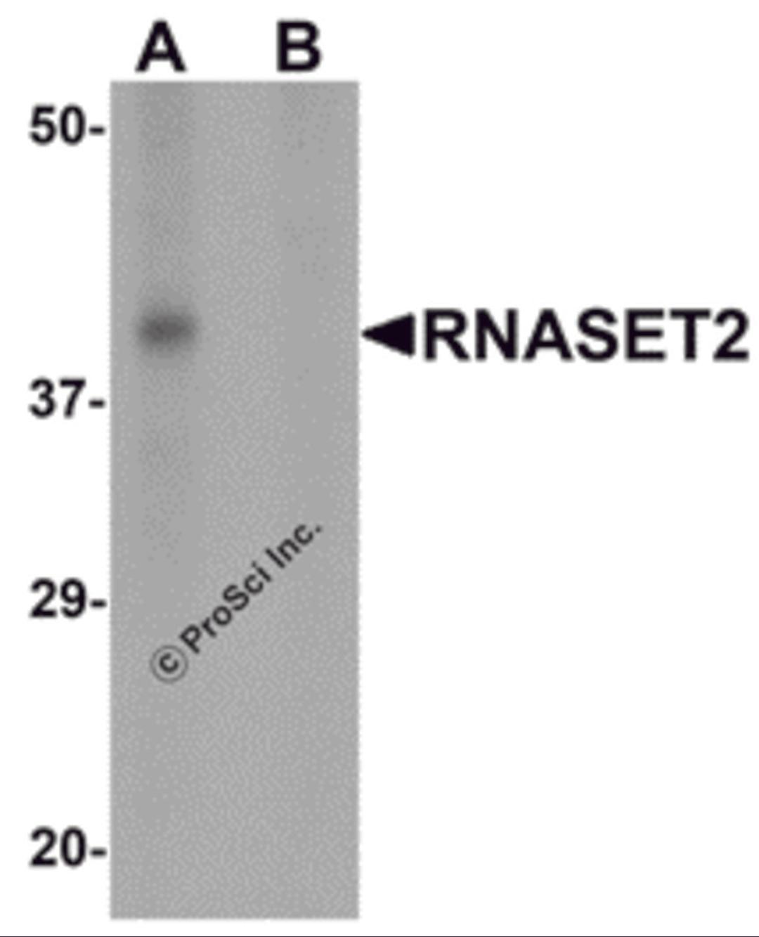 Western blot analysis of RNASET2 in SW480 cell lysate with RNASET2 antibody at 1 μg/mL in (A) the absence and (B) the presence of blocking peptide.