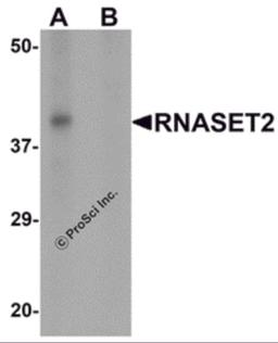 Western blot analysis of RNASET2 in SW480 cell lysate with RNASET2 antibody at 1 μg/mL in (A) the absence and (B) the presence of blocking peptide.