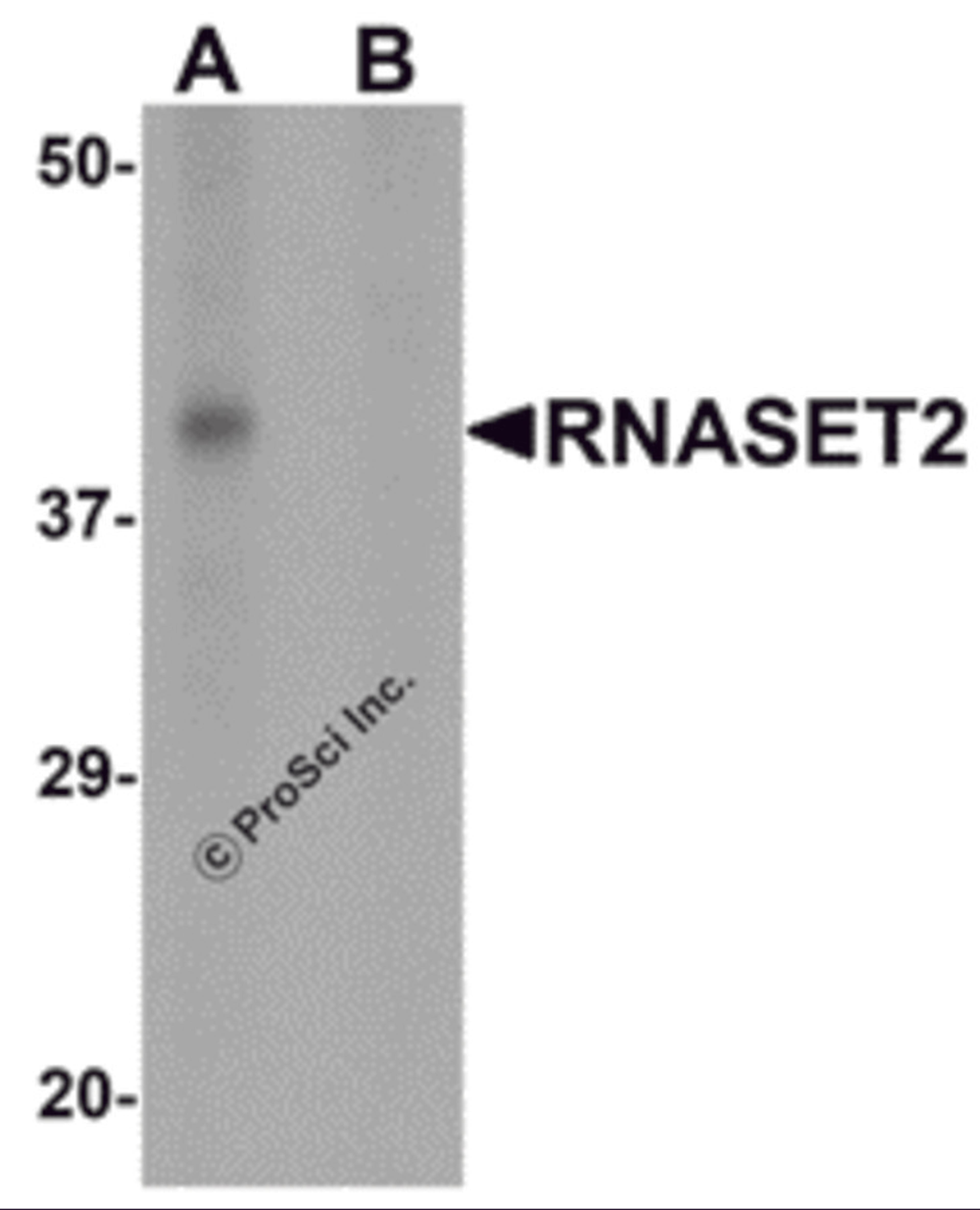 Western blot analysis of RNASET2 in SW480 cell lysate with RNASET2 antibody at 1 μg/mL in (A) the absence and (B) the presence of blocking peptide.