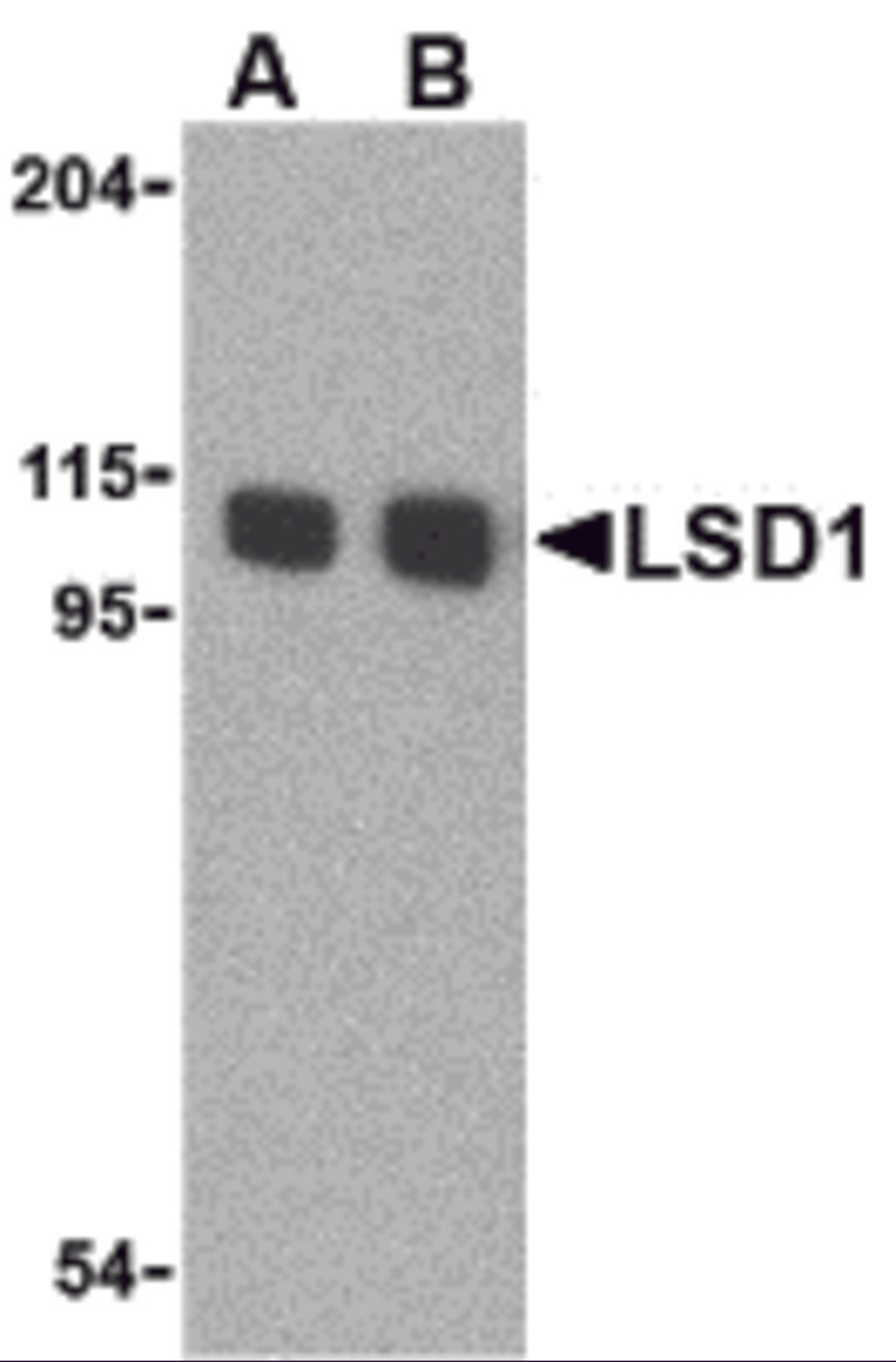 Western blot analysis of LSD1 in P815 cell lysate with LSD1 antibody at (A) 1 and (B) 2 &#956;g/mL.