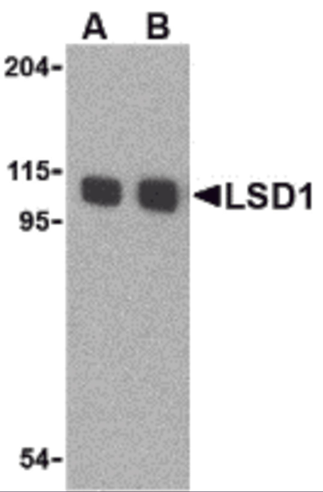 Western blot analysis of LSD1 in P815 cell lysate with LSD1 antibody at (A) 1 and (B) 2 μg/mL.