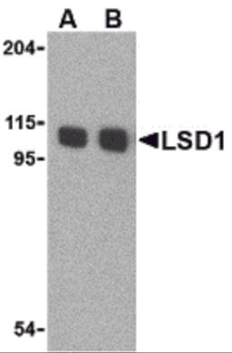 Western blot analysis of LSD1 in P815 cell lysate with LSD1 antibody at (A) 1 and (B) 2 μg/mL.
