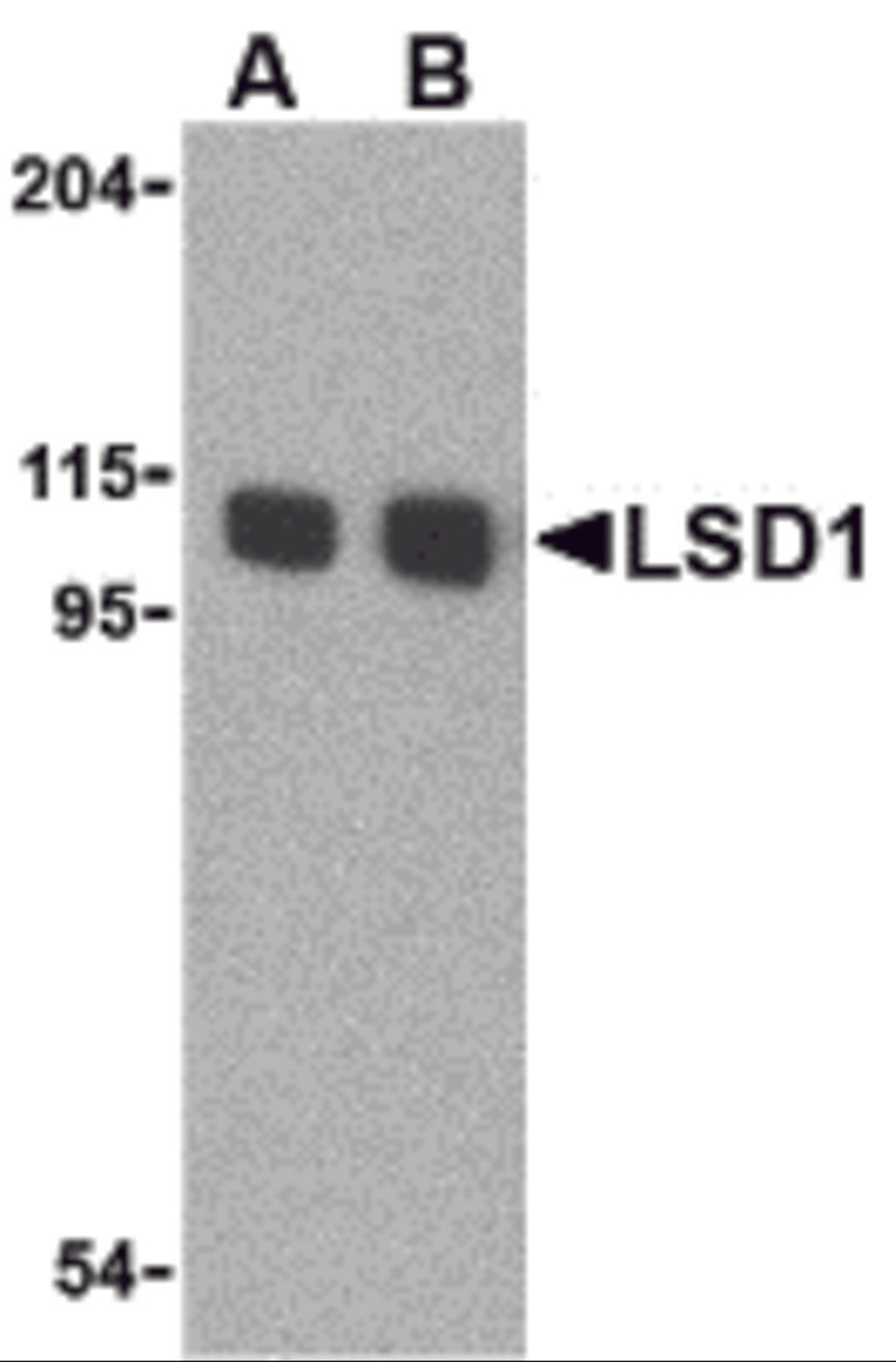 Western blot analysis of LSD1 in P815 cell lysate with LSD1 antibody at (A) 1 and (B) 2 μg/mL.