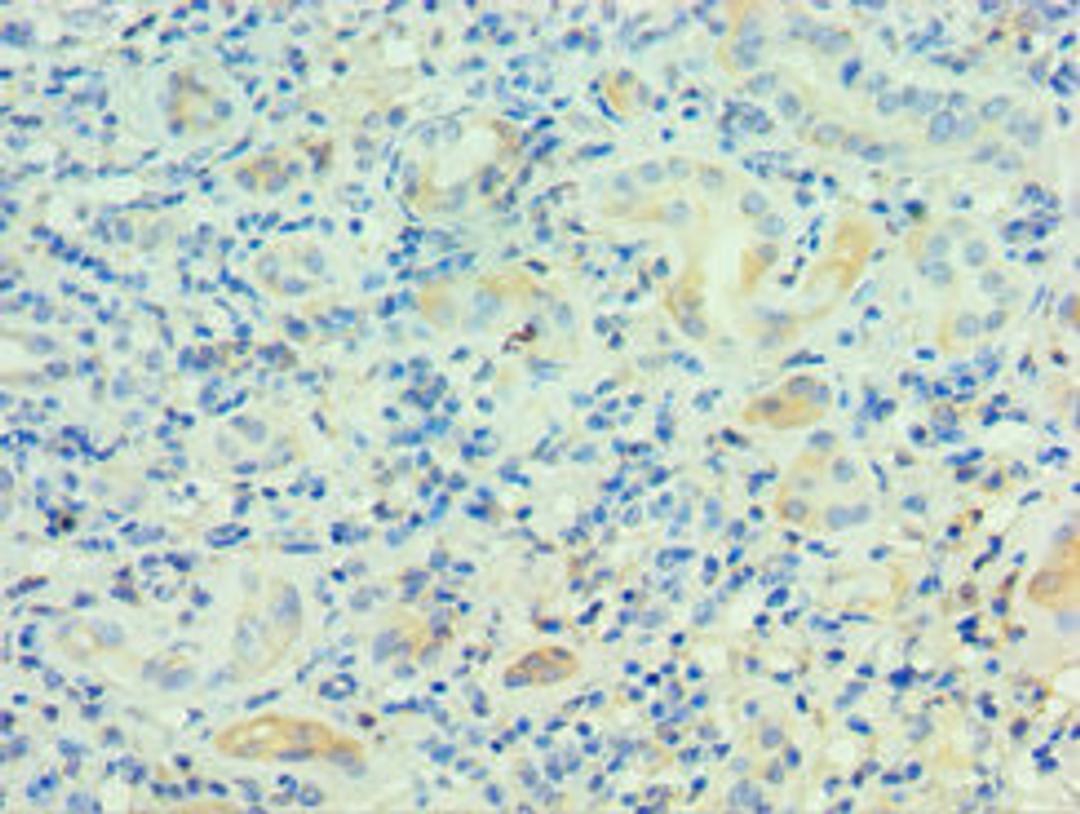 Immunohistochemistry of paraffin-embedded human kidney tissue using CSB-PA018849ESR1HU at dilution of 1:100